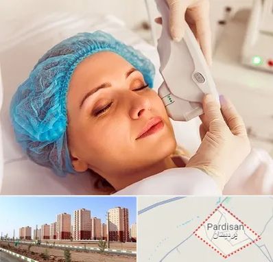 اکسنت در پردیسان قم