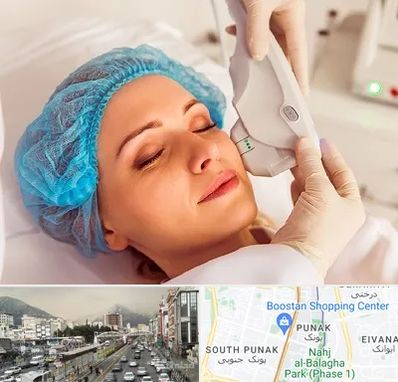 اکسنت در پونک 