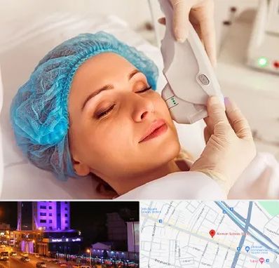 اکسنت در آبرسان تبریز