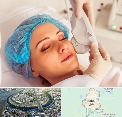 اکسنت در بابل