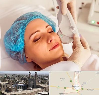 اکسنت در سبزوار