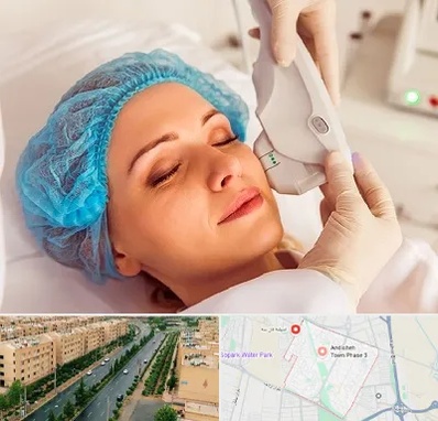 اکسنت در فاز سه اندیشه