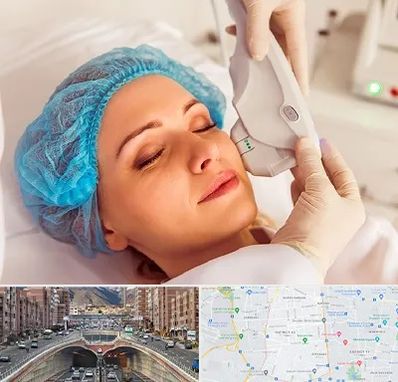 اکسنت در منطقه 10 تهران 