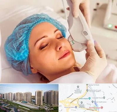 اکسنت در المپیک 