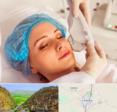 اکسنت در کامیاران