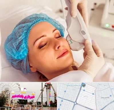 اکسنت در پادادشهر اهواز