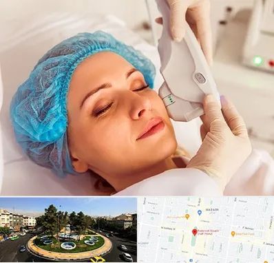 اکسنت در هفت حوض 