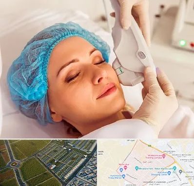 اکسنت در الهیه مشهد