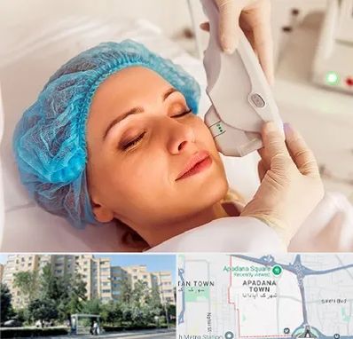 اکسنت در آپادانا