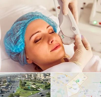 اکسنت در کمال شهر کرج 