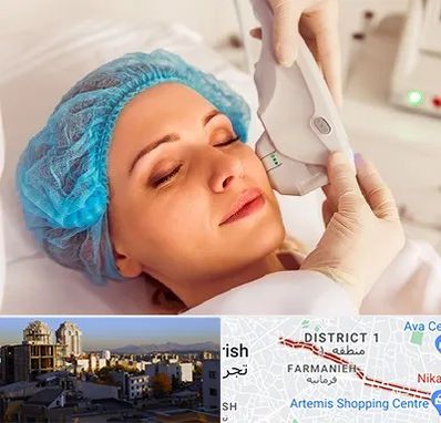 اکسنت در فرمانیه 