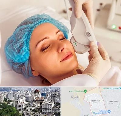 اکسنت در ولنجک 