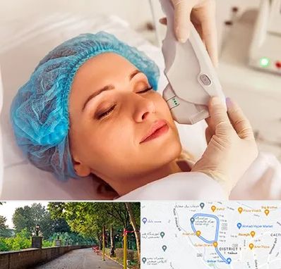 اکسنت در بلوار گیلان رشت