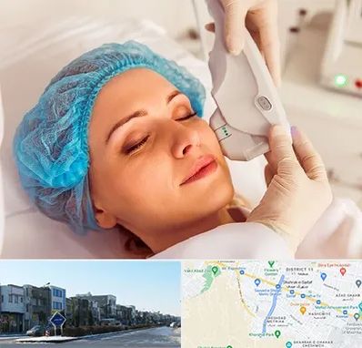 اکسنت در شریعتی مشهد