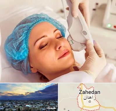 اکسنت در زاهدان