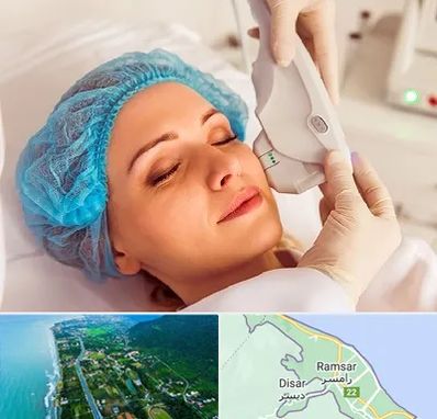 اکسنت در رامسر