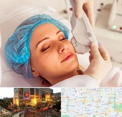 اکسنت در جنت آباد تهران 