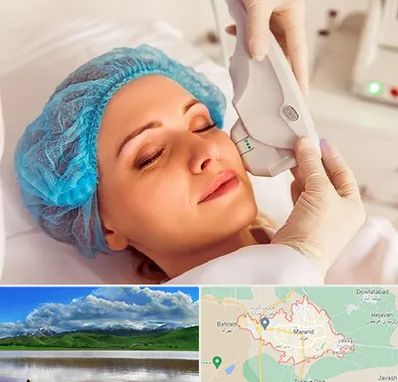 اکسنت در مرند