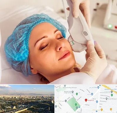 اکسنت در هنگام 