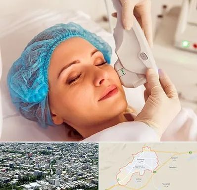 اکسنت در شاهرود