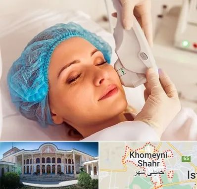 اکسنت در خمینی شهر