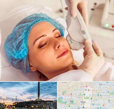 اکسنت در منطقه 2 تهران 