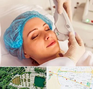 اکسنت در وکیل آباد مشهد 