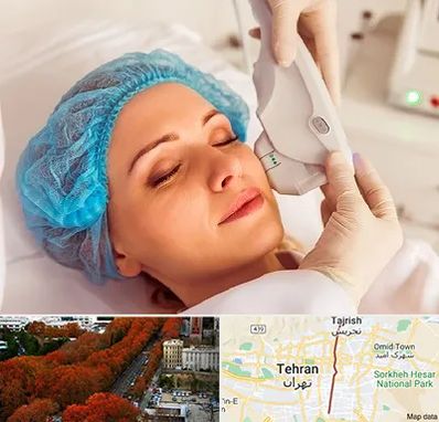 اکسنت در ولیعصر 