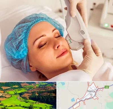 اکسنت در نکا