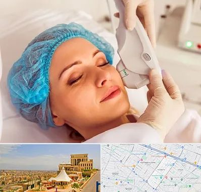 اکسنت در هاشمیه مشهد