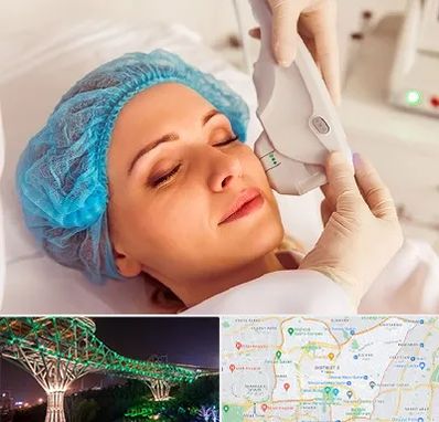 اکسنت در منطقه 3 تهران 