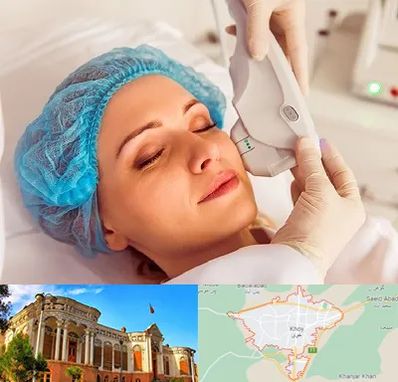 اکسنت در خوی