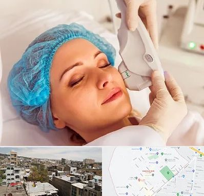 اکسنت در شمیران نو