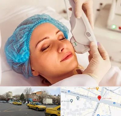 اکسنت در شهناز تبریز