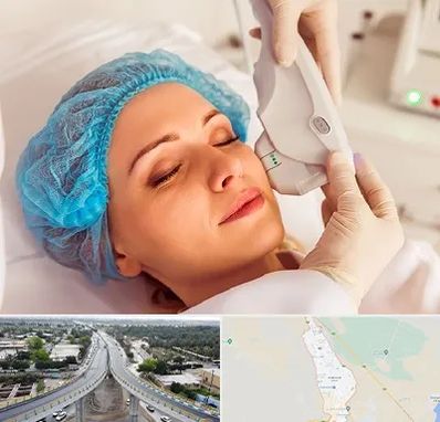 اکسنت در اندیمشک