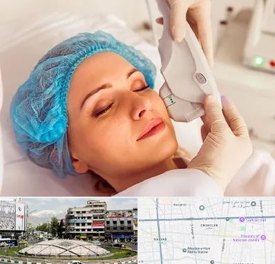 اکسنت در مرکز تهران