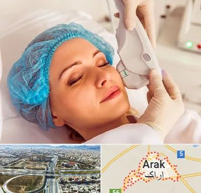 اکسنت در اراک