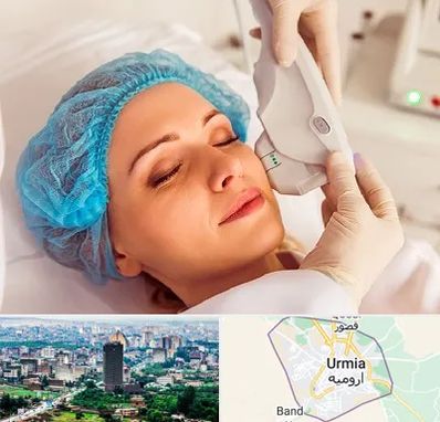 اکسنت در ارومیه