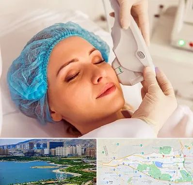 اکسنت در منطقه 22 تهران 