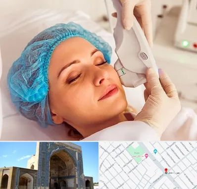 اکسنت در مصلی مشهد