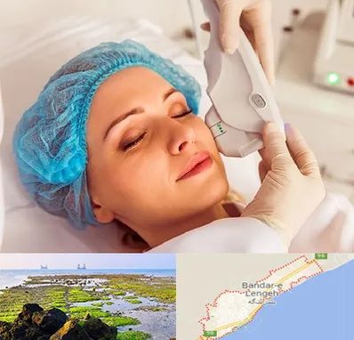 اکسنت در بندرلنگه