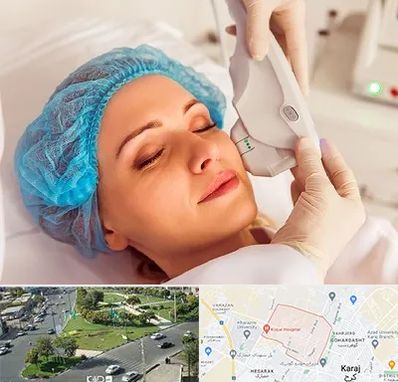 اکسنت در شاهین ویلا کرج