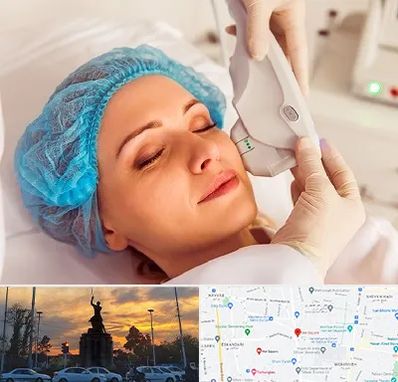 اکسنت در میدان حر 