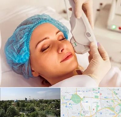 اکسنت در منطقه 16 تهران 