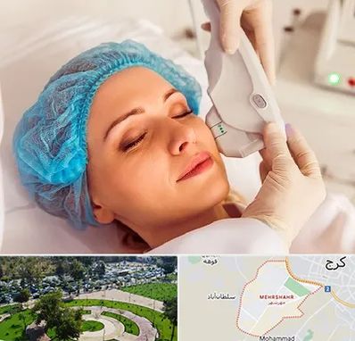 اکسنت در مهرشهر کرج 