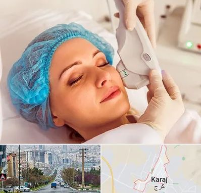 اکسنت در گوهردشت کرج 