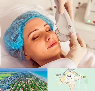 اکسنت در ساری