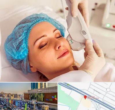 اکسنت در لاله پارک تبریز