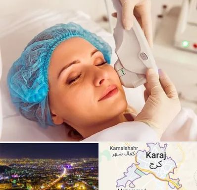 اکسنت در کرج