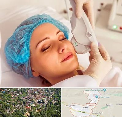 اکسنت در دماوند